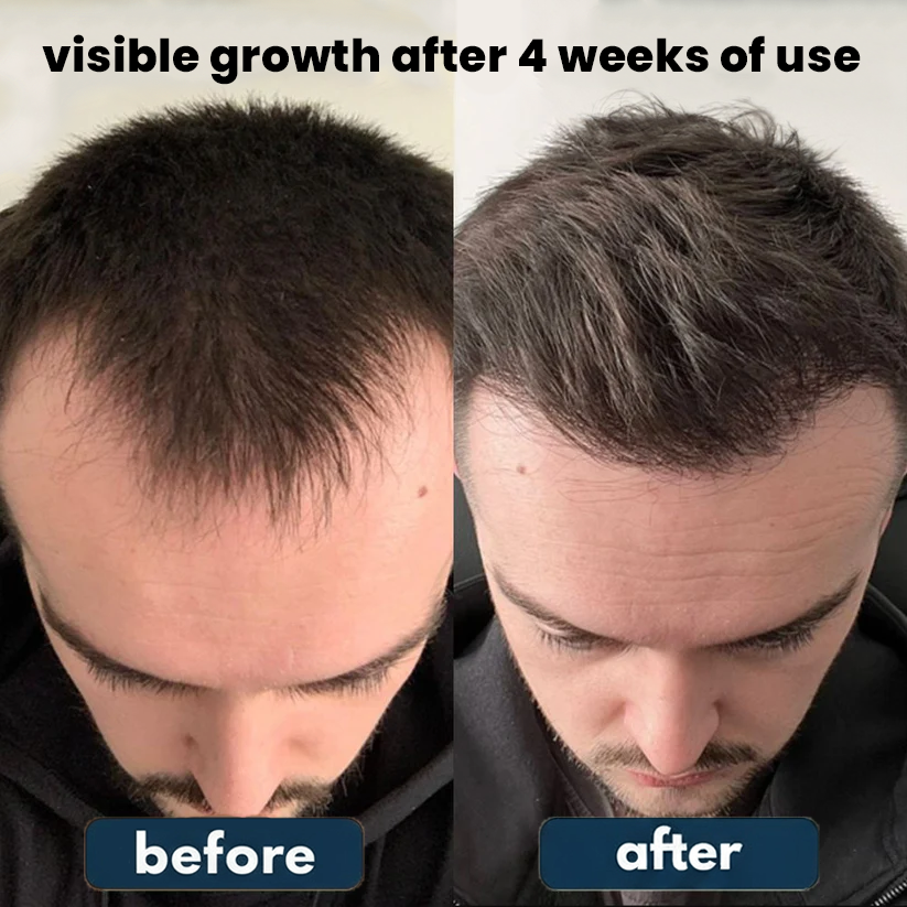 Bodywise Hair Growth Roll-On Serum